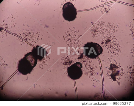 Black Aspergillus with long hyphae Black Aspergillus with long hyphae 99635277
