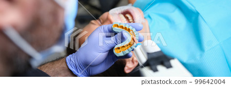 Dentist holds cast with veneers on plaster model and patient in dental clinic Dentist holds cast with veneers on plaster model and patient in dental clinic 99642004