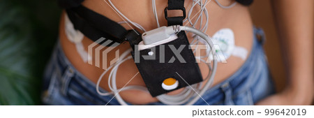 Woman wears device, device for daily ECG monitoring 99642019
