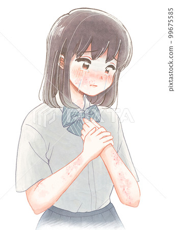 一名患有過敏性蕁麻疹的高中女生的插圖 99675585