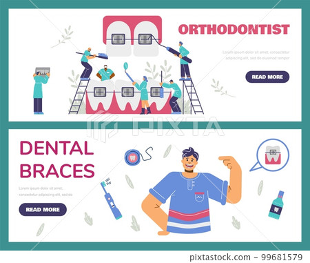 Orthodontic and installation of dental braces banners flat vector illustration. Orthodontic and installation of dental braces banners flat vector illustration. 99681579