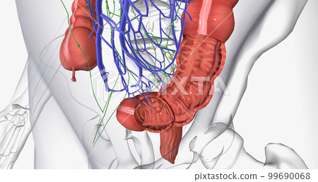 Colorectal cancer (CRC) is a common colon or rectal cancer that affects many patients over middle age. 99690068