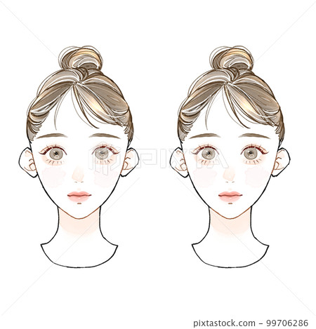 Face length x Centrifugal face / Face length x Centripetal face Face length x Centrifugal face / Face length x Centripetal face 99706286