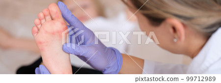 Doctor conducts medical examination of leg of child with red itchy rash closeup Doctor conducts medical examination of leg of child with red itchy rash closeup 99712989