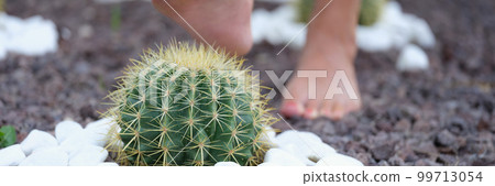 Human leg with painful heel and cactus thorns pierce a woman leg 99713054