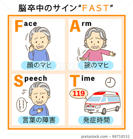 Stroke check FAST explanation illustration 1 99718531
