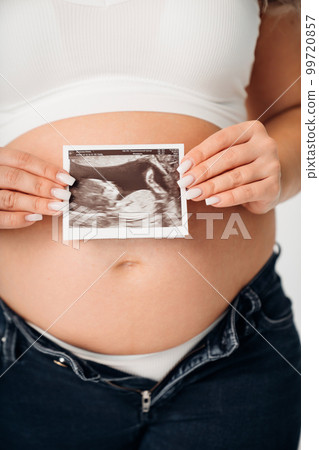 a pregnant woman in a white top holding a picture of the ultrasound in his hands 99720857