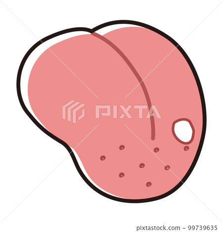 舌頭有口腔炎的插圖 舌頭有口腔炎的插圖 99739635