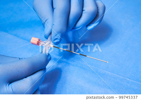 Epidural Anesthesia. Needle for anesthesia in the hands of a medic in protective gloves 99745337