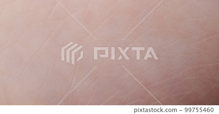 Lines on human skin background Lines on human skin background 99755460
