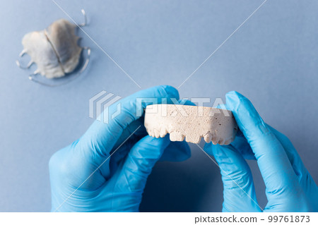 plaster cast of child's jaw in the hands of dentist. pediatric dentistry 99761873