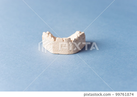 plaster cast of the children's upper jaw. Correction of bite. 99761874