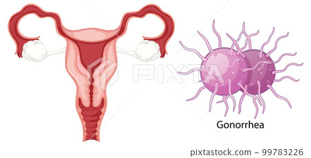 Vaginal infection bacteria concept 99783226