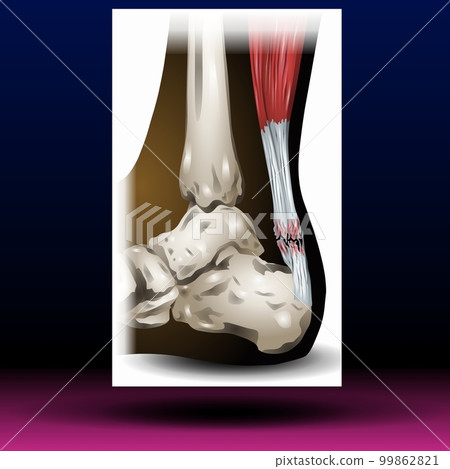 Back Leg Bone - Body Parts - Organ - Pharma Back Leg Bone - Body Parts - Organ - Pharma 99862821