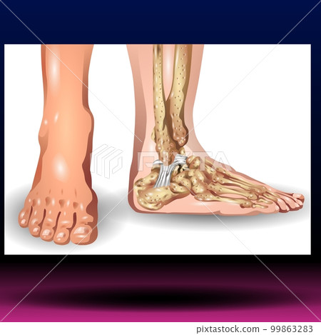Anterior Longitudinal Ligament - Body Parts - Spine - Skeleton - Medical - Graphic - Joint 99863283