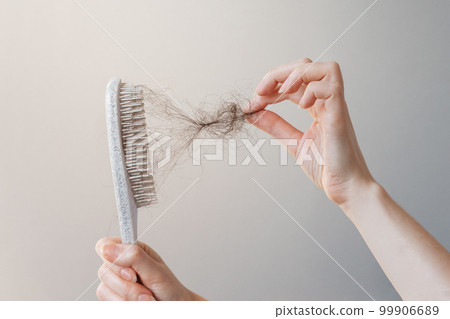 Female hand pulls out a clump of hair from a comb. Close-up. The concept of alopecia and hair loss 99906689