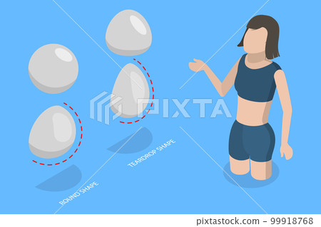 3D Isometric Flat Vector Conceptual Illustration of Breast Implant Types 99918768
