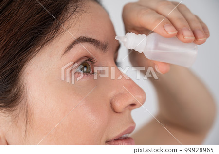 Caucasian woman dripping moisturizing drops into her eyes. Caucasian woman dripping moisturizing drops into her eyes. 99928965