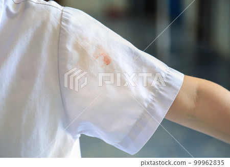dirty stain on kid shirt at part of shirt from daily life activity for cleaning concept. selective focus. 99962835