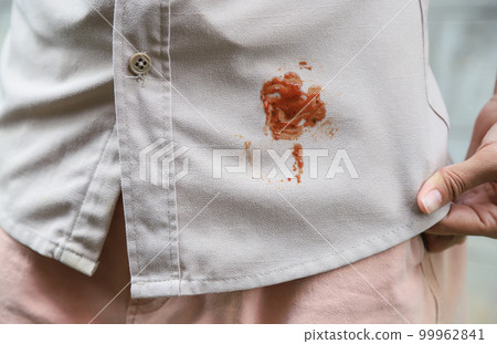 Hand showing dirty sauce stain on shirt from accident in eating in daily life. selective focus. stain for cleaning 99962841