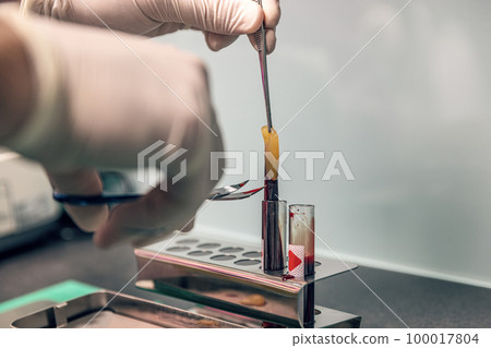 Platelet-rich fibrin application Platelet-rich fibrin application 100017804