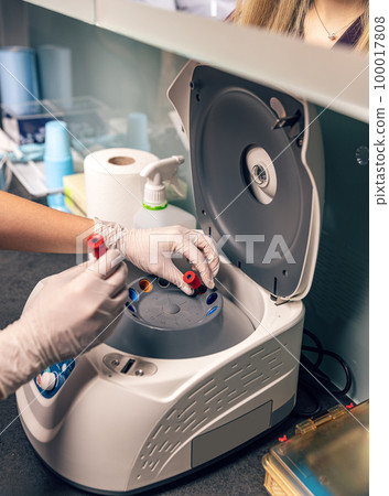 Blood samples tested in the laboratory Blood samples tested in the laboratory 100017808