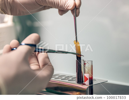 Platelet Rich Fibrin 100017833