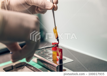 Platelet rich fibrin 100017935