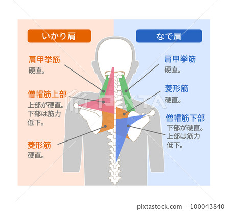 錨肩和斜肩的肌肉結構 錨肩和斜肩的肌肉結構 100043840