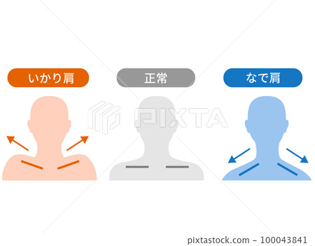 碇肩和斜肩的區別 碇肩和斜肩的區別 100043841