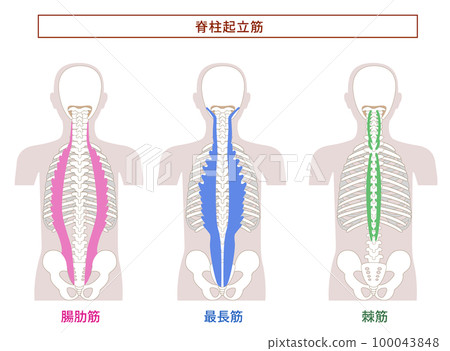 豎脊肌；髂肋肌、最長肌、棘肌的解剖肌肉插圖 100043848