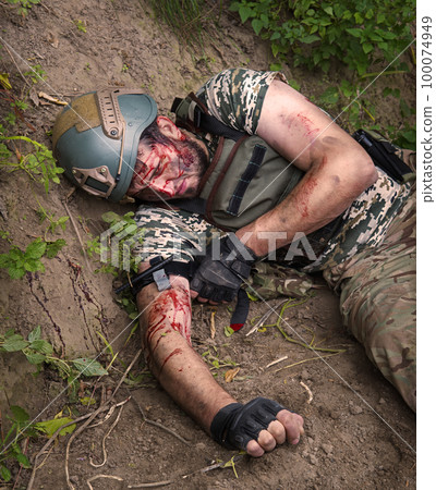 A wounded soldier stops the bleeding 100074949