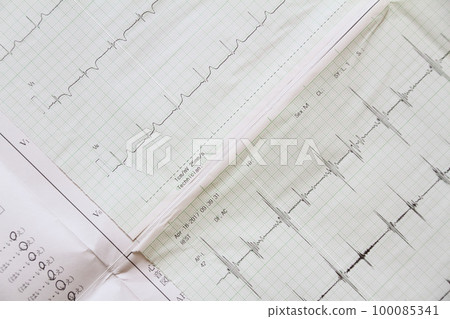 ECG/heartbeat test results notification 100085341