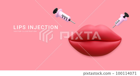 3d realistic banner for lip augmentation procedure. Lips injection of hyaluronic acid. Beauty clinic concept. Vector illustration 3d realistic banner for lip augmentation procedure. Lips injection of hyaluronic acid. Beauty clinic concept. Vector illustration 100114071