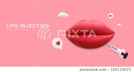 3d realistic banner for lip injection. Concept of dermatology and cosmetology treatment. Red aesthetic beautiful lips with medical plastic syringe with cosmetic injection in cartoon style 3d realistic banner for lip injection. Concept of dermatology and cosmetology treatment. Red aesthetic beautiful lips with medical plastic syringe with cosmetic injection in cartoon style 100114075