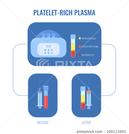 Human blood plasma after centrifugation infographic poster 100121691