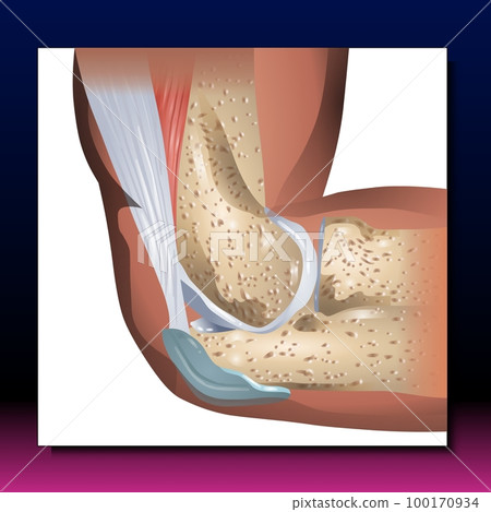Elbow Elbow 100170934