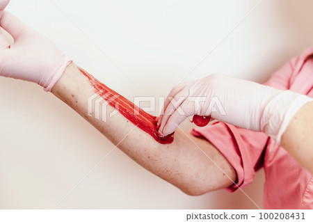 Shugaring master applying thick sugar paste on lady's hand, removing unwanted hair. Hair removal with a special sugar paste has many advantages over wax depilation Shugaring master applying thick sugar paste on lady's hand, removing unwanted hair. Hair removal with a special sugar paste has many advantages over wax depilation 100208431