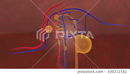 The cysts caused by PKD block the blood vessels and urine producing tubes within the kidneys The cysts caused by PKD block the blood vessels and urine producing tubes within the kidneys 100211582