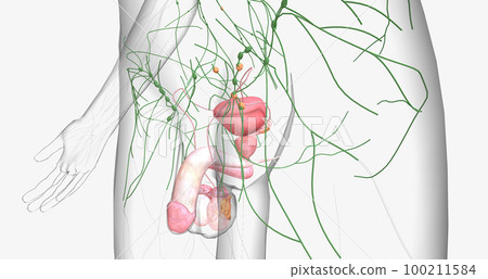 Stage II testicular cancer is characterized by the spread of cancer to nearby regional lymph nodes. Stage II testicular cancer is characterized by the spread of cancer to nearby regional lymph nodes. 100211584