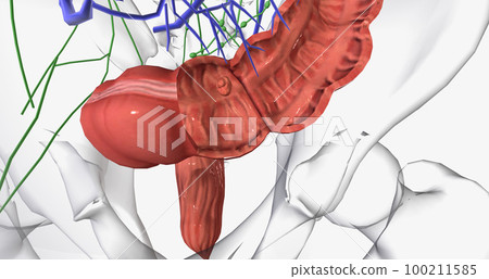 Colorectal cancer (CRC) is a common colon or rectal cancer that affects many patients over middle age. Colorectal cancer (CRC) is a common colon or rectal cancer that affects many patients over middle age. 100211585