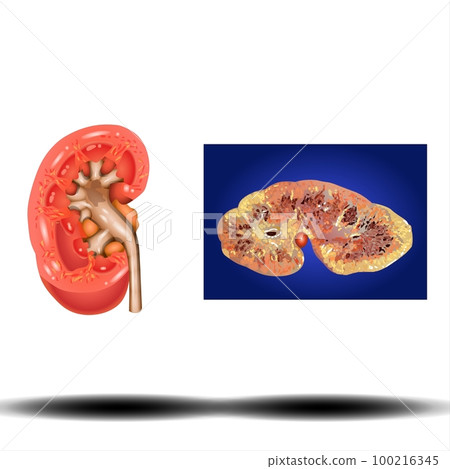 Kidney - internal organ Kidney - internal organ 100216345