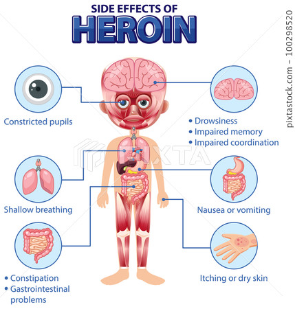 Human anatomy diagram cartoon style of Heroin side effects 100298520