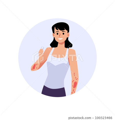 Woman having atopic dermatitis holding tablet for treatment flat style Woman having atopic dermatitis holding tablet for treatment flat style 100323466