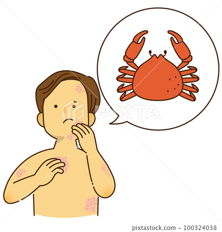 A man who is itchy due to a crab allergy 100324038
