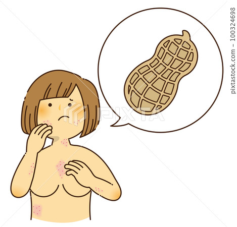 A woman who is itchy due to a peanut allergy A woman who is itchy due to a peanut allergy 100324698