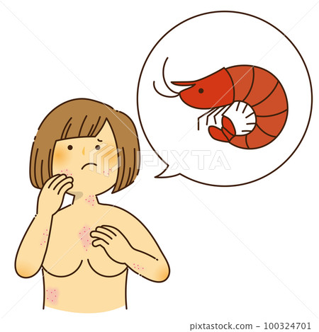 A woman who is itchy due to shrimp allergy 100324701