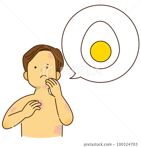 因雞蛋過敏而瘙癢的女性 100324703