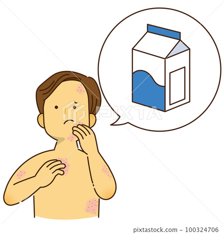 A man who is itching due to milk allergy 100324706