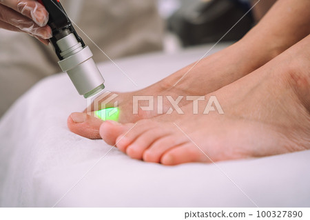 Close up shot of gloved hand with the laser hair removal machine's handpiece along woman leg. Alexandrite laser techhnology removing hair. Beauty procedure Close up shot of gloved hand with the laser hair removal machine's handpiece along woman leg. Alexandrite laser techhnology removing hair. Beauty procedure 100327890